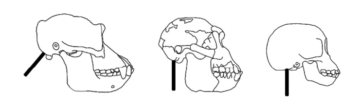 A line drawing of a skull

Description automatically generated