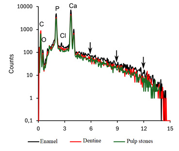 Spectra obtained during X-ray microanalysis of enamel, dentin and pulp of a tooth. The arrows indicate the spectrum of enamel, which shows the strongest mineralization
