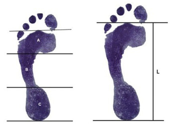 This figure shows two footprints subvidied into areas labelled A, B, C which are used in the calculation of the arch index of the foot.