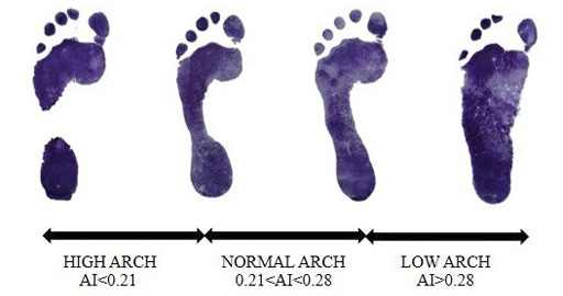 This figure shows four different footprints starting from lower to higher food arch index (from left to right).
