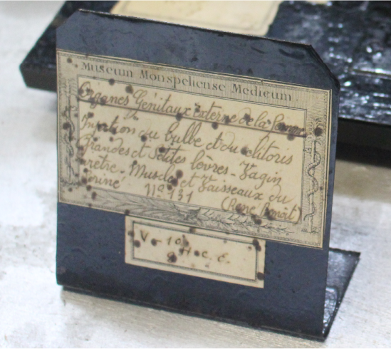 Détail des organes génitaux externes féminins : bulbe, clitoris, lèvres, vagin, urètre, muscles et vaisseaux du périnée. Préparation sèche de René Benoît, XIXᵉ siècle. Collection MH (2004), Université de Montpellier. 