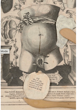 From veiled female form to Medusa-like figure, the anatomical flap sequence reveals layers of the uterus, ending with a foetus. A visual journey through femininity and anatomy in Remmelin’s Catoptrum microcosmicum (1619). 