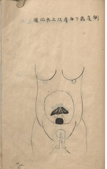 A comparative view of 18th-century obstetrical texts—from Deventer (1701), Genteki (1775), to Coudray (1769)—reveals the global spread of childbirth knowledge across Europe and Asia, blending tradition with anatomical insight. 