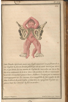 A comparative view of 18th-century obstetrical texts—from Deventer (1701), Genteki (1775), to Coudray (1769)—reveals the global spread of childbirth knowledge across Europe and Asia, blending tradition with anatomical insight. 